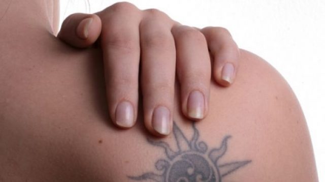 Dampak Buruk dan Bahaya Tato Bagi Kulit