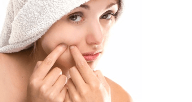 4 Hal Yang Harus Dihindari Saat Berjerawat