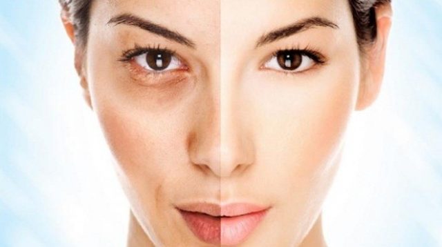 8 Tips Mengatasi Kulit Wajah yang Kendur Secara Alami