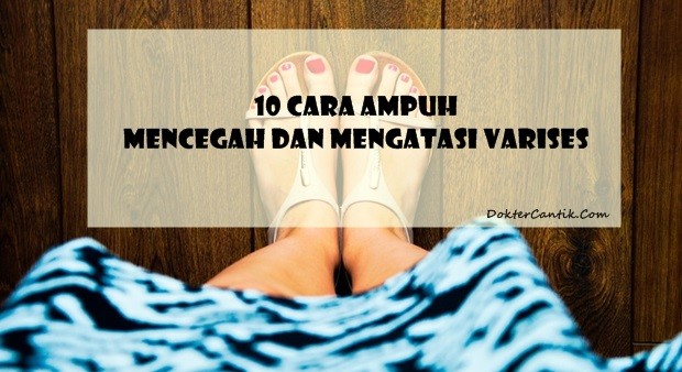  VARISES  10 Cara  Ampuh Mencegah dan Mengatasi  Varises  