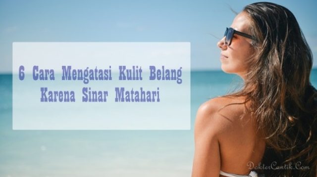 6 Cara Mengatasi Kulit Belang Karena Sinar Matahari